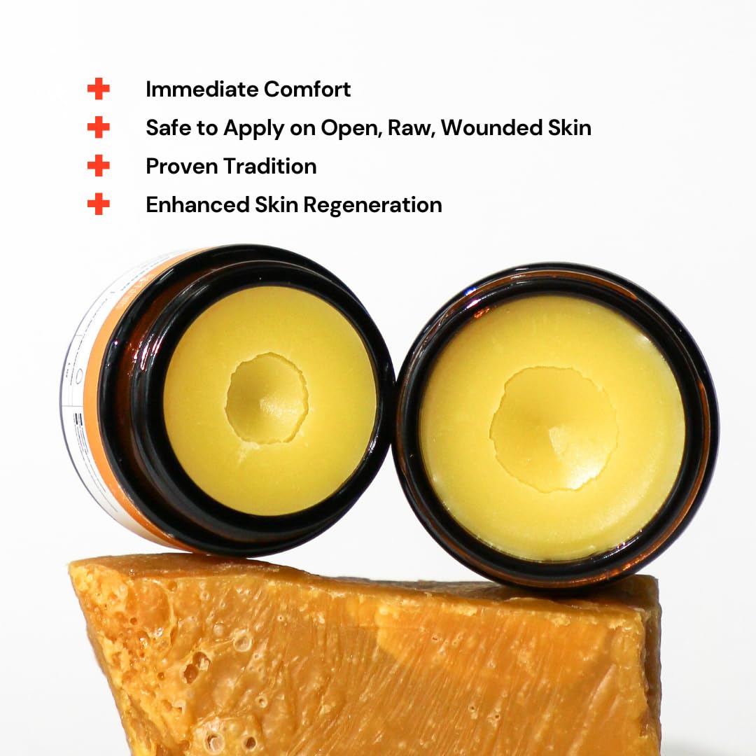 Universal Skin Healer Essential Oil Free Formula | Eczema | Hidradenitis Suppurativa | Irritated & Dry Skin | Wound Healing | Post Operative Stitches | Dermatitis | Pilonidal cyst | Anal Fissures