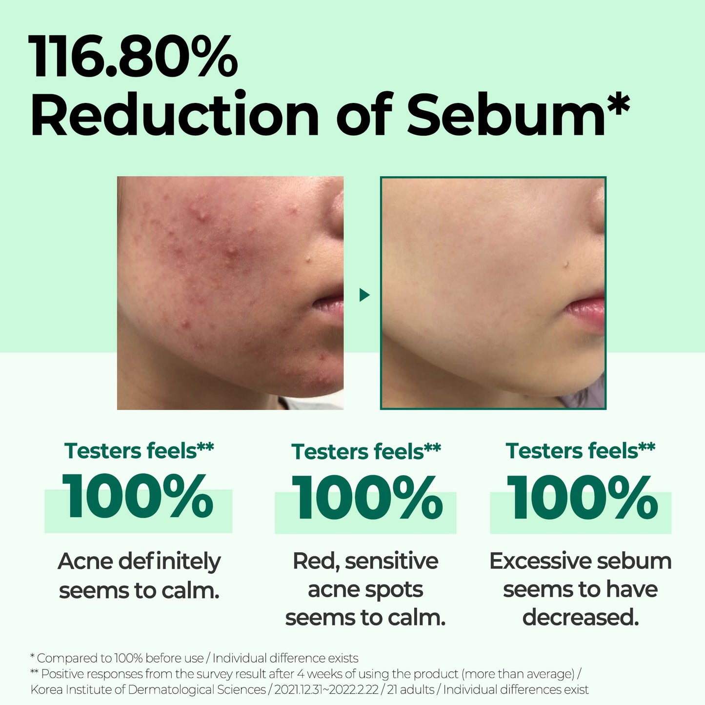 SOME BY MI AHA BHA PHA 30 Days Miracle Toner - 5.07Oz, 150ml - Made from Tea Tree Leaf Water for Sensitive Skin - Mild Exfoliating Daily Face Toner - Acne, Sebum and Oiliness Care - Korean Skin Care